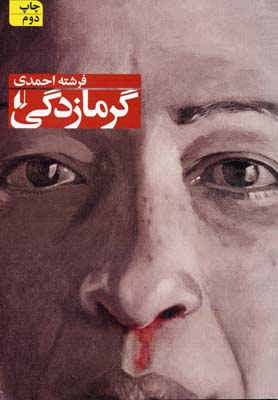 گرمازدگی